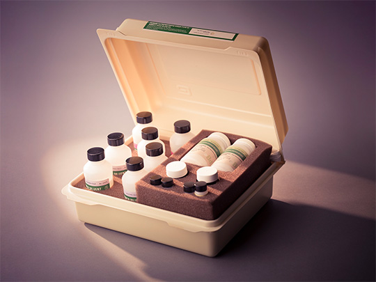 Open HIV testing kit containing reagent bottles, test vials, and supplies arranged in a foam-lined carrying case (1985).