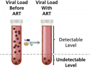 viral_load_art